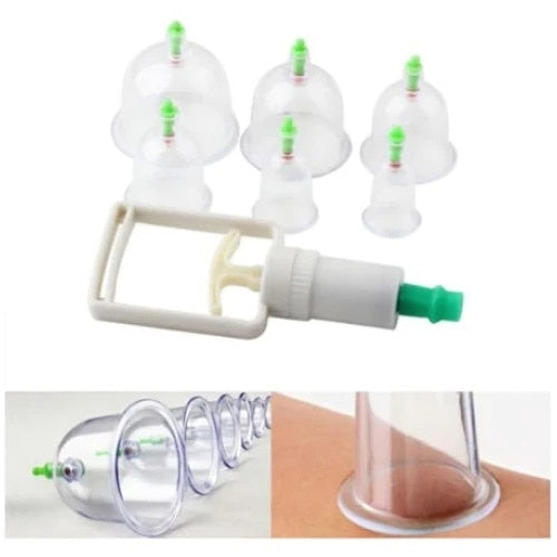 Set aparat cu vacuum cu 12 ventuze FOXMAG24 medicinale, terapeutice