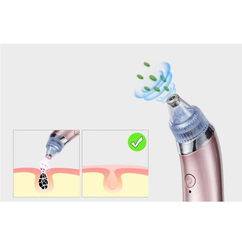 Aparat pentru curatarea punctelor negre XN-8030