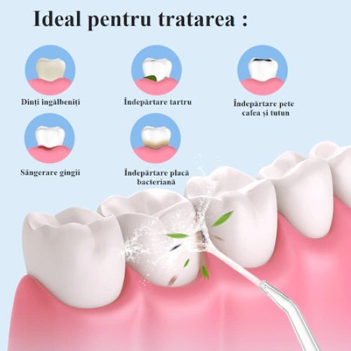 Irigator Profesional Oral pentru dus bucal, Curatare Anti-Tartru, Portabil, Rezervor 220 ml, Verde