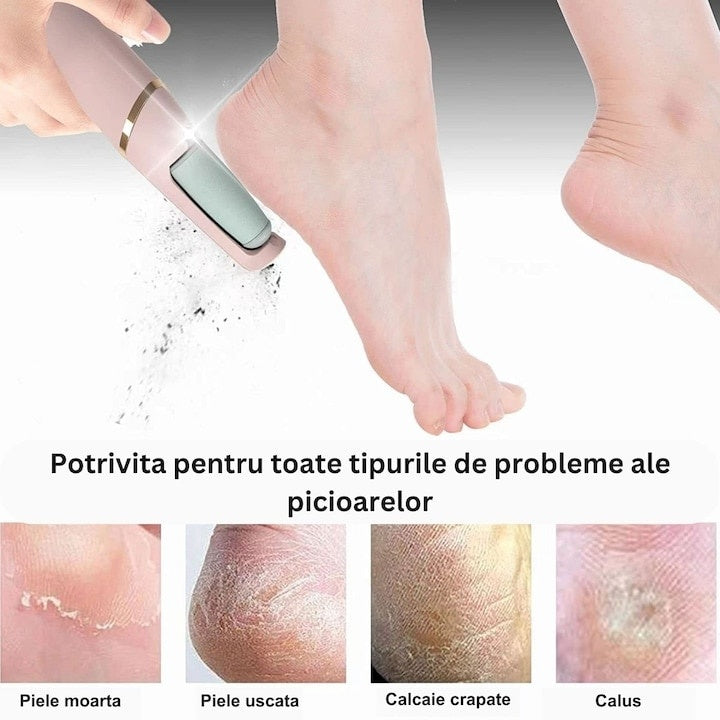 Pila pentru talpi si calcaie, electrica, incarcare USB, cu periuta de curatare, 2 viteze de functionare, lumina LED, alb/roz