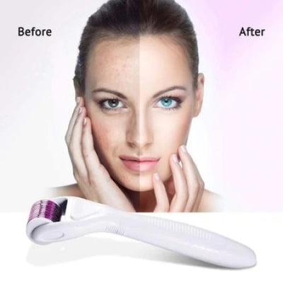 Set dermaroller FOXMAG24® pentru masaj facial, regenerare, diminuare riduri, exfoliere si purificare, 6 piese